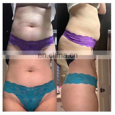 360 Hot Test Sale Vacuum Machine Price Fat Freezing Cavitation Portable Slimming Machine photo-5