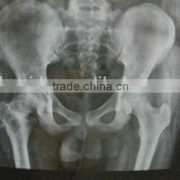 radiography film + dental , fuji medical x-ray film for digital xray dry