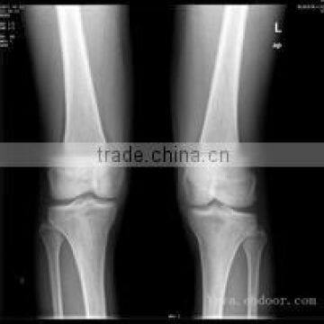 Konida medical x-ray fuji dry film agfa drystar films processing machine