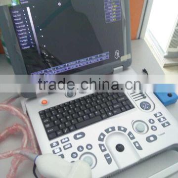 Portable Ultrasound Machine CU18A Made by Latest Color Ultrasoun Technology