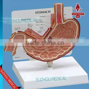 Pathological stomach dissection model