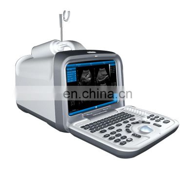 Portable medical black and white ultrasound machine Full digital diagnostic ultrasound