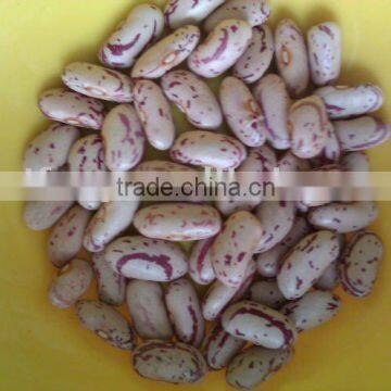 Light Speckled Kidney Bean ( long shape,2010 crop, yian origin)