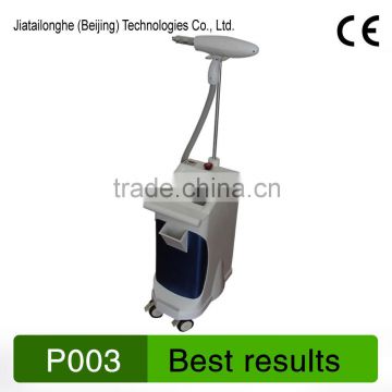 2016 professional epilation laser hair removal machine ipl epilation laser hair removal machine for tatoo removal