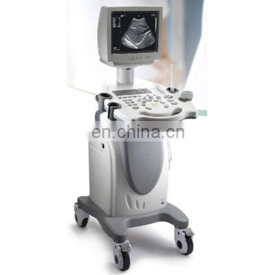 Full Digital Black and White Laptop Doppler Diagnostic System Ultrasound photo-2