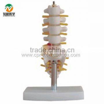 BIX-A1012 Mini lumbar spine vertebra With Tail Vertebrae model