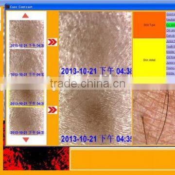 AYJ-J019 Facial Skin Moisture Monit Analyzer/digital Skin Analyzer photo-4