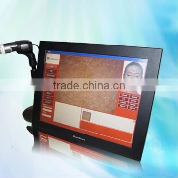 Smart auto-digital high quality skin scope analyzer