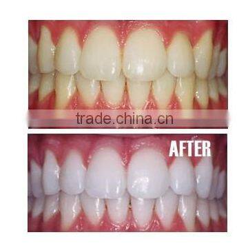 Teeth Whitening Tooth Whitener Gel Pen photo-3