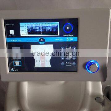 Portable Hifu/hifu Machine/High No Pain Intensity Focused Ultrasound Hifu High Frequency Machine For Face photo-4