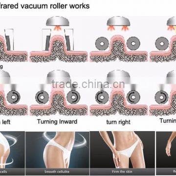 Cavitat Slimming Vacuum Liposuction Machine Price photo-6