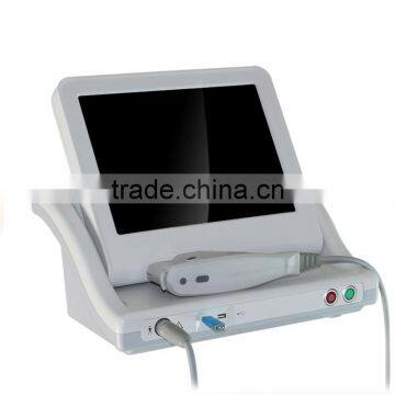 Waist Shaping 2016 Hifu High Intensity Ultrasound Hifu Face Lifting Ultrasound Knife Hifu Ultrasound Beauty Machine Nasolabial Folds Removal photo-2