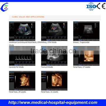 Ultrasound Machine Color Doppler