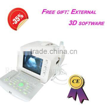 Promotion!!CE approved Notebook USB Ultrasound Scanner with 3.5Mhz multi-frequency convex probe RUS-6000A