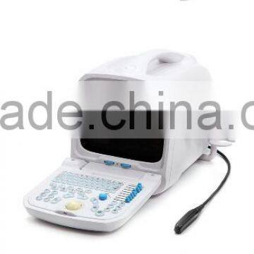 Widely Used 3D Full Digital Portable Ultrasound Scanner Suitable for the Diagnosis of Abdomen, Cardiac, Gynecology, Obstetrics photo-3