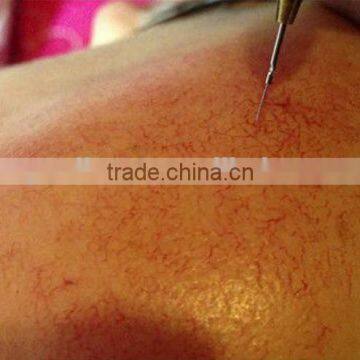 2016 Beauty Equipment Spider Vein Removal