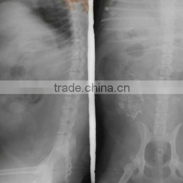 x ray blue film, medical x ray film, x ray film china