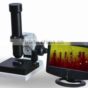 New Arrival Blood Microcirculation Analyzer with good quality