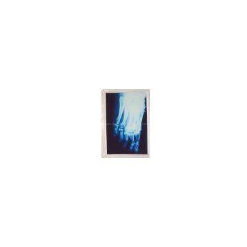 medical x-ray film, medical dry film x-ray machine accessories, mobile digital x-ray film