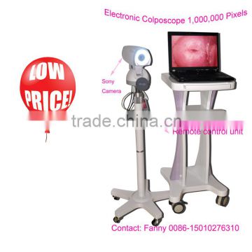 Digital High-Pixel Electronic Colposcope(RCS-500ii) with 1,000,000 pixels