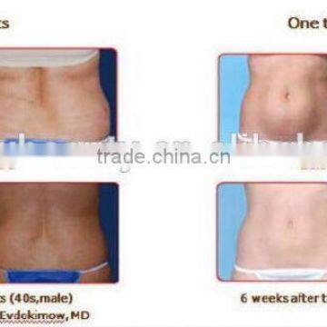 Single Fat Freezing /fat Freezing Slimming Machine / Fat Freezing Machine photo-6