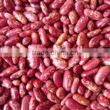 Light Speckled Kidney Bean
