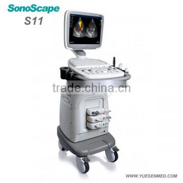 medical mobile 4d trolley color ultrasound Sonoscape s11