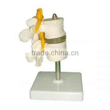 Human Body Anatomy Spine Model Lumbar Vertebra photo-3