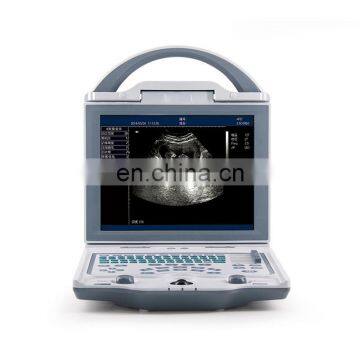 MY-A013C 10 years medical supplier laptop b/w ultrasound scan veterinary portable ultrasound machine price