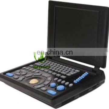 China High-accuracy PC system Portable Platform Laptop Ultrasound Equipment